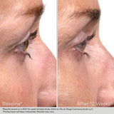 Obagi Nu-Cil™ Eyelash Enhancing Serum