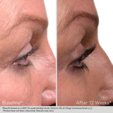 Obagi Nu-Cil™ Eyelash Enhancing Serum