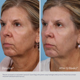 SUZANOBAGIMD Claribright
