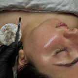 Dermaplaning + BioRePeel