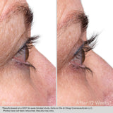 Obagi Nu-Cil™ Eyelash Enhancing Serum