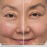 Obagi Nu-Cil™ Eyebrow Boosting Serum