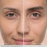 Obagi Nu-Cil™ Eyebrow Boosting Serum
