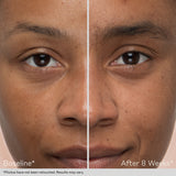 Obagi Nu-Cil™ Eyebrow Boosting Serum