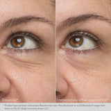 Obagi Hydro-Drops Rejuvenating Eye Gel Cream