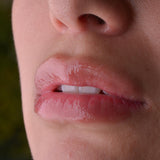 Hidratación de Labios con Skinbooster de Galderma