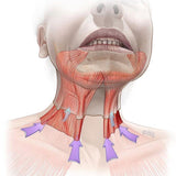 Nefertiti Lift con Toxina Botulínica (Dysport®)
